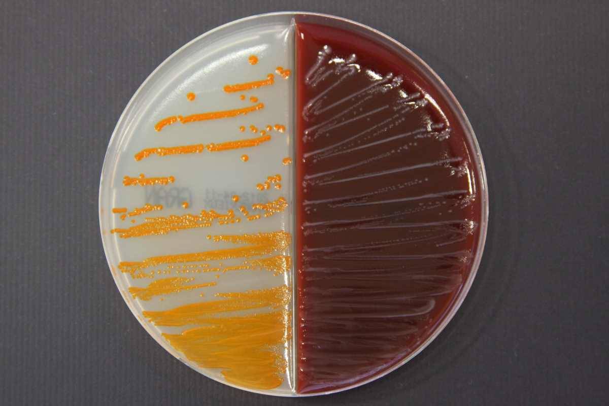 Streptococcus agalactiae culture sur gélose Granada et gélose au sang. © Université de Tours, MEREGHETTI Laurent