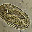 Trichostrongle gastro-intestinal : oeuf embryonné avec larve "en huit"