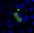Cellules MDBK infectées par des sporozoïtes d’Eimeria tenella. Les noyaux des cellules sont marqués en bleu par le DAPI. Les sporozoïtes, exprimant la YFP, apparaissent en vert.