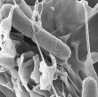 Réarrangements de la surface cellulaire induits par les mécanismes d'invasion de Salmonella; Microscopie à balayage