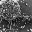 Dialogue entre une cellule dendritique et Toxoplasma gondii. Microscopie électronique à balayage. © Univ. Tours, éq. Biomédicaments antiparasitaires