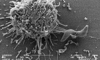 Dialogue entre une cellule dendritique et Toxoplasma gondii. Microscopie électronique à balayage. © Univ. Tours, éq. Biomédicaments antiparasitaires
