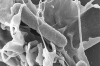 Réarrangements de la surface cellulaire induits par les mécanismes d'invasion de Salmonelle; microscopie à balayage. © INRAE, WIEDEMANN A. - Univ. Tours, SIZARET P-Y