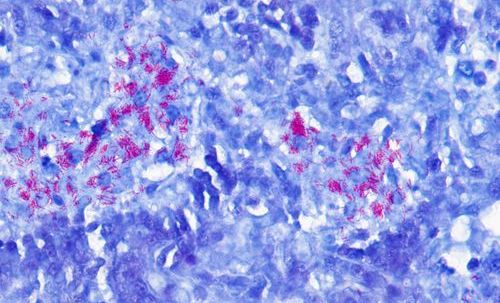Détection de Mycobacterium bovis dans des poumons de souris 7 semaines après infection (Coloration de Ziehl modifiée, grossissement X 600). © INRAE, COCHARD Thierry